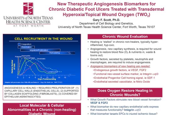 New Therapeutic Angiogenesis Biomakrers for Chronic Diabetic Foot Ulcers Treated with Transdermal Hyperoxia/Topical wound Oxygen (TWO2)