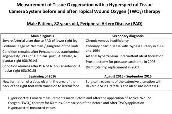 Measurement of Tissue Oxygenation with a Hyperspectral Tissue Camera System before and after Topical Wound Oxygen (TWO2 therapy